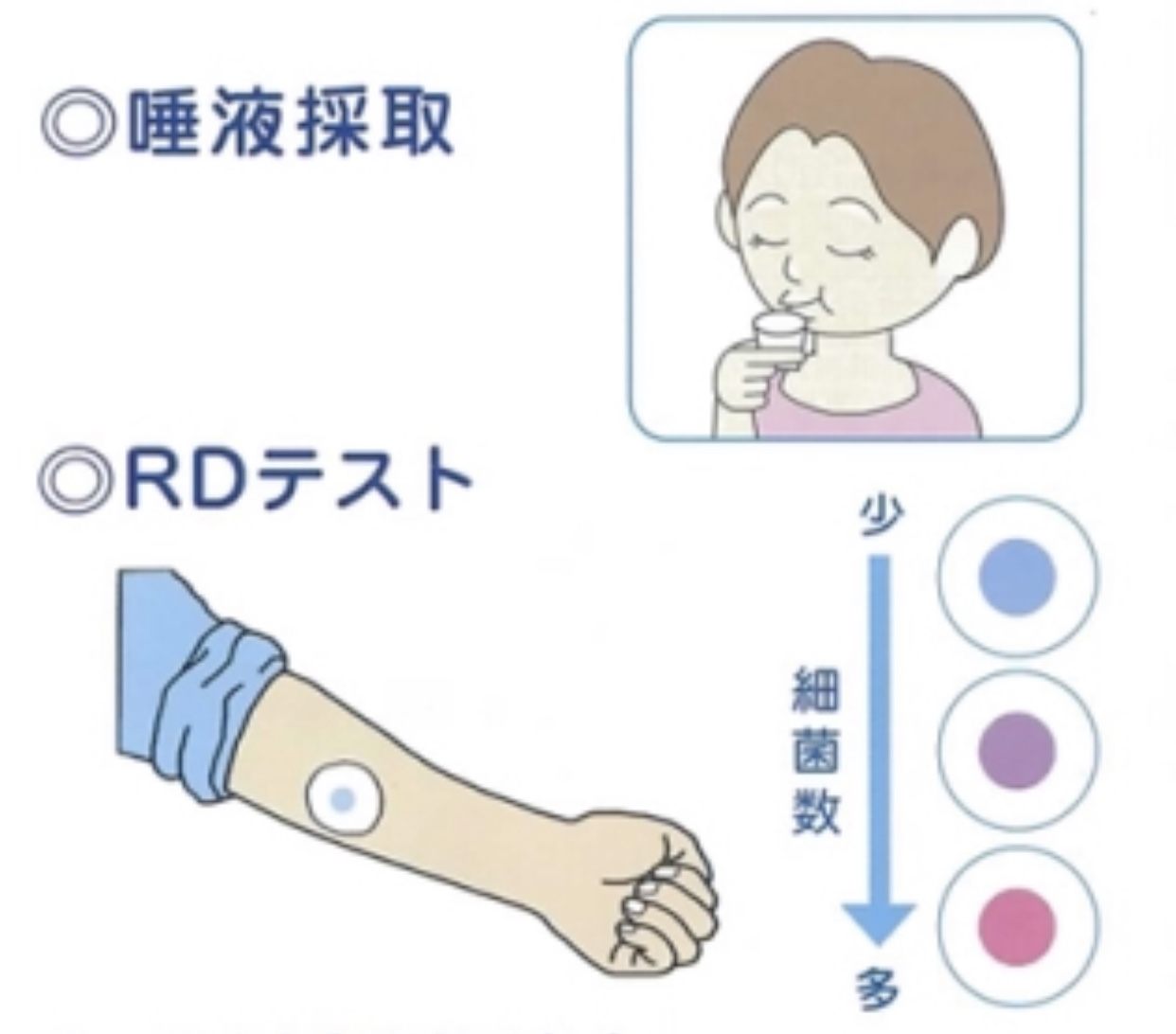 RDテスト　40回分　虫歯リスクチェック